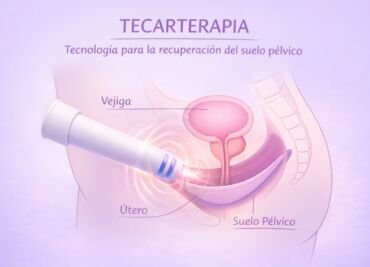 Tecarterapia en suelo pélvico
