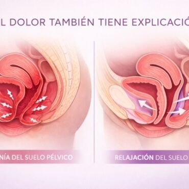 Dispareunia